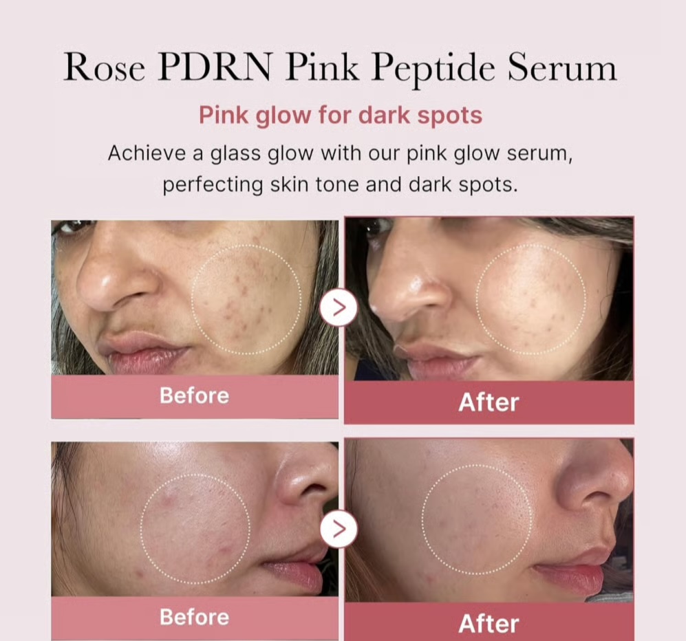 img_2109 pdrn pink serum